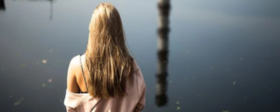 油脂性脫發怎么辦