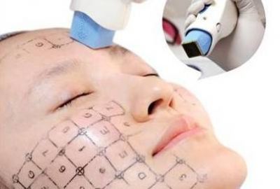 熱瑪吉副作用和危害都有哪些