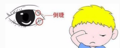 為什么下睫毛倒長