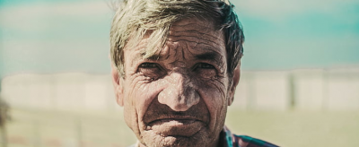 眼角紋和笑紋該怎么去除