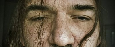 眼角紋和笑紋該怎么去除