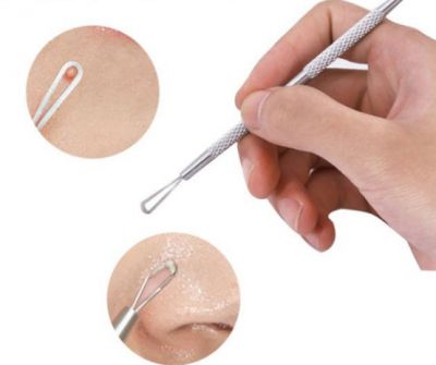 臉上的粉刺一定要挑出來嗎