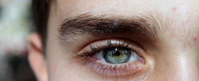 2024241911310 去黑眼圈小妙招