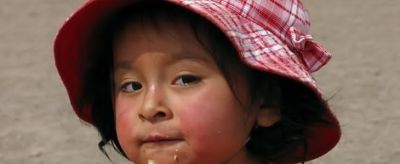 皮膚有紅血絲怎么辦