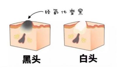 2054534611311