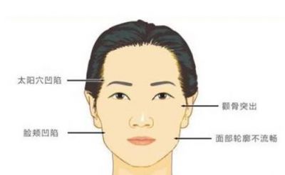 怎么瘦顴骨小竅門