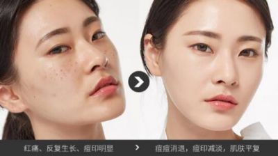 法蘭琳卡蘆薈膠的使用方法