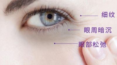 睡不著失眠導致長黑眼圈怎么辦