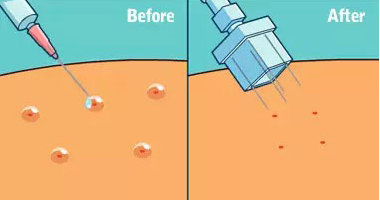 做水光24小時后化妝了可以嗎