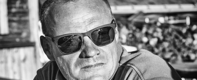 怎么祛除老年斑