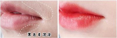 臉上很多汗毛有效脫毛方法