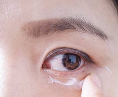 眼周細紋怎么消除