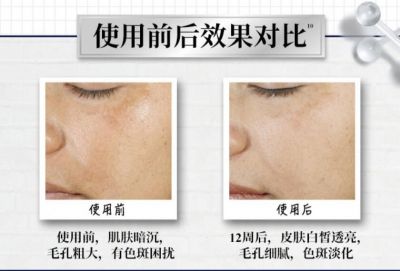 科顏氏淡斑精華怎么查詢真偽