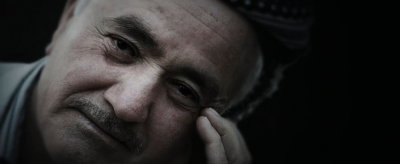 脂肪粒怎么去除小竅門