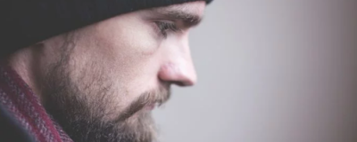 紫外線過敏怎么辦