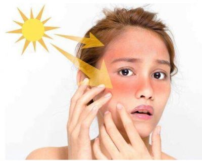 皮膚曬紅了怎樣快速美白