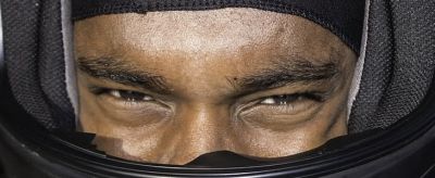 油性皮膚毛孔粗大怎么辦