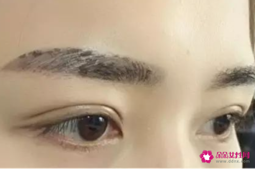 紋的眉怎么去掉的小方法