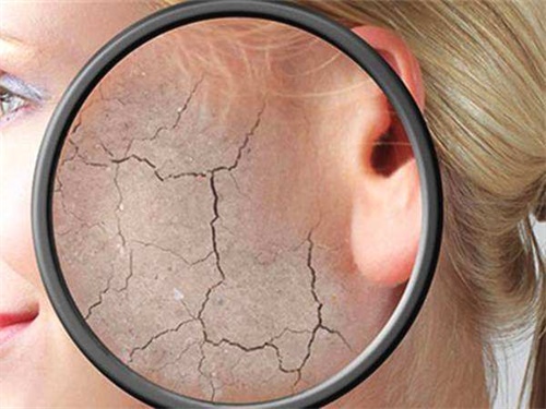 8_2019130154330431_4 皮膚干燥瘙癢怎么辦