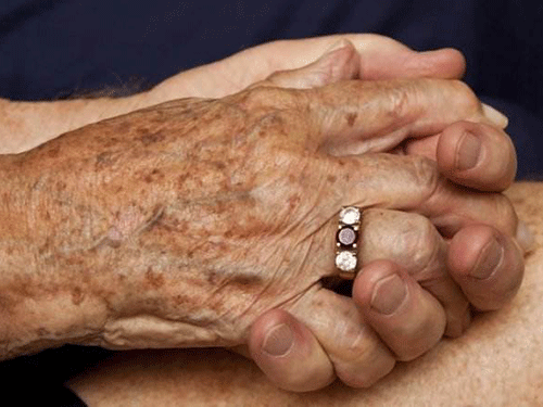 8_201978230613320_4 臉上長老年斑是什么原因