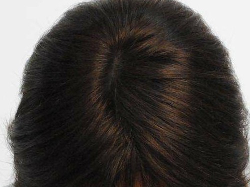 那款洗發水去油效果好