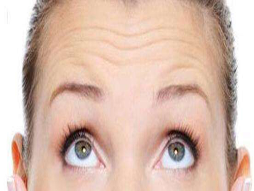 怎樣消除額頭紋