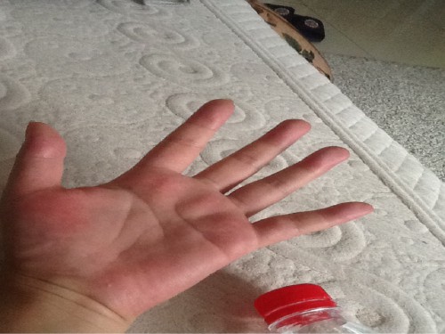 手部皮膚粗糙怎么辦