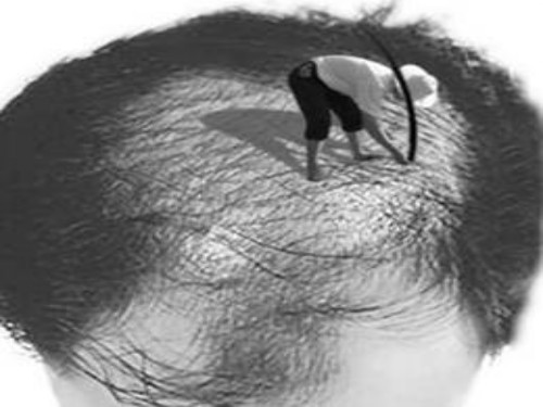 斑禿的原因及治療方法