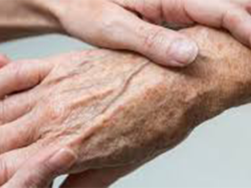 8_201943140529886_4 怎么去掉老年斑