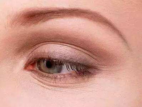 眼角有細紋怎么辦