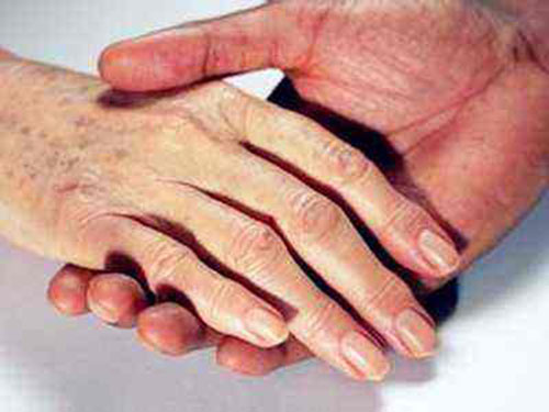 8_2019628151434229_4 手上有老年斑怎么去除小妙招