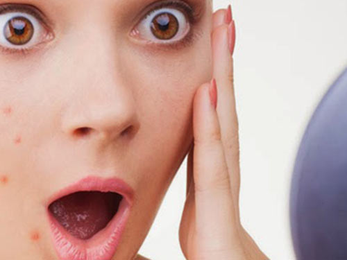 8_2019628165216542_4 如何減少青春痘