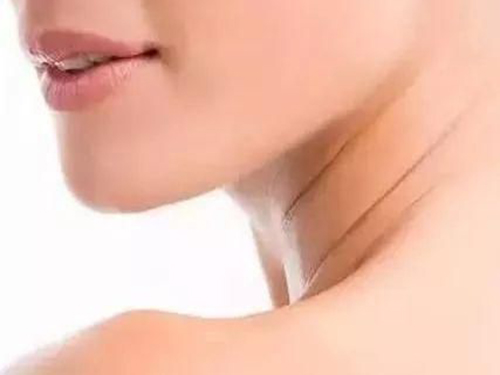 頸紋很深是什么原因