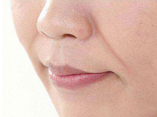 8_201977232753764_4 怎樣減輕法令紋