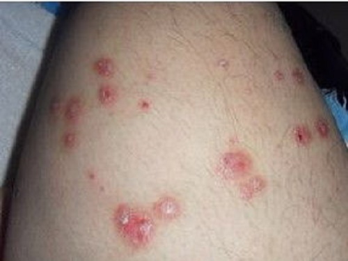 8_2019812163337218_4 皮膚病的種類