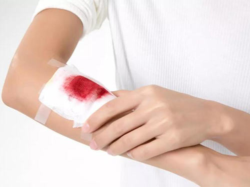 怎樣去除手術后疤痕