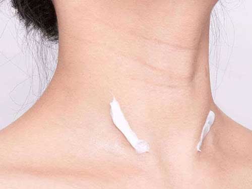 頸部除皺最好的辦法